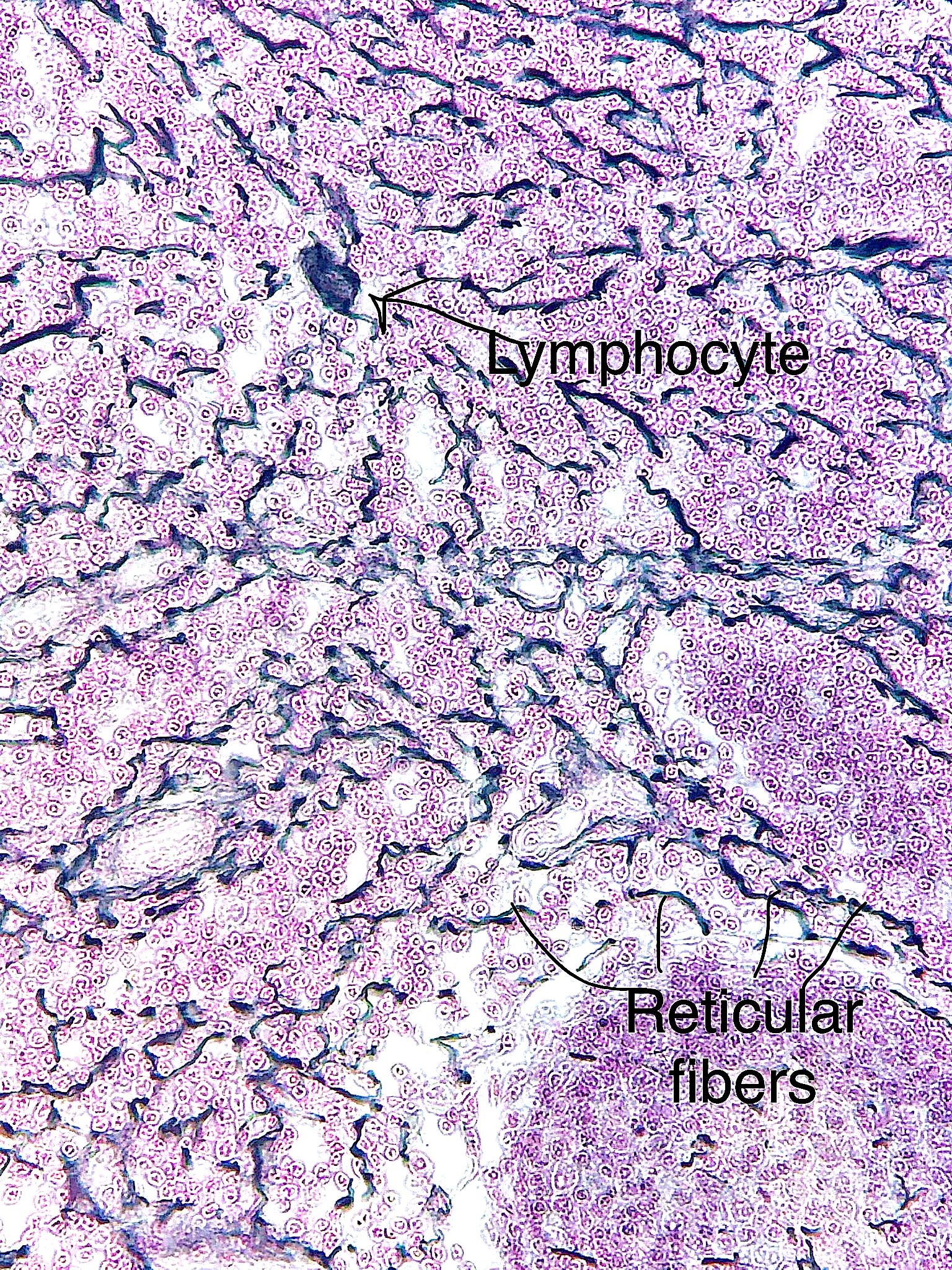 reticularconnective tissue