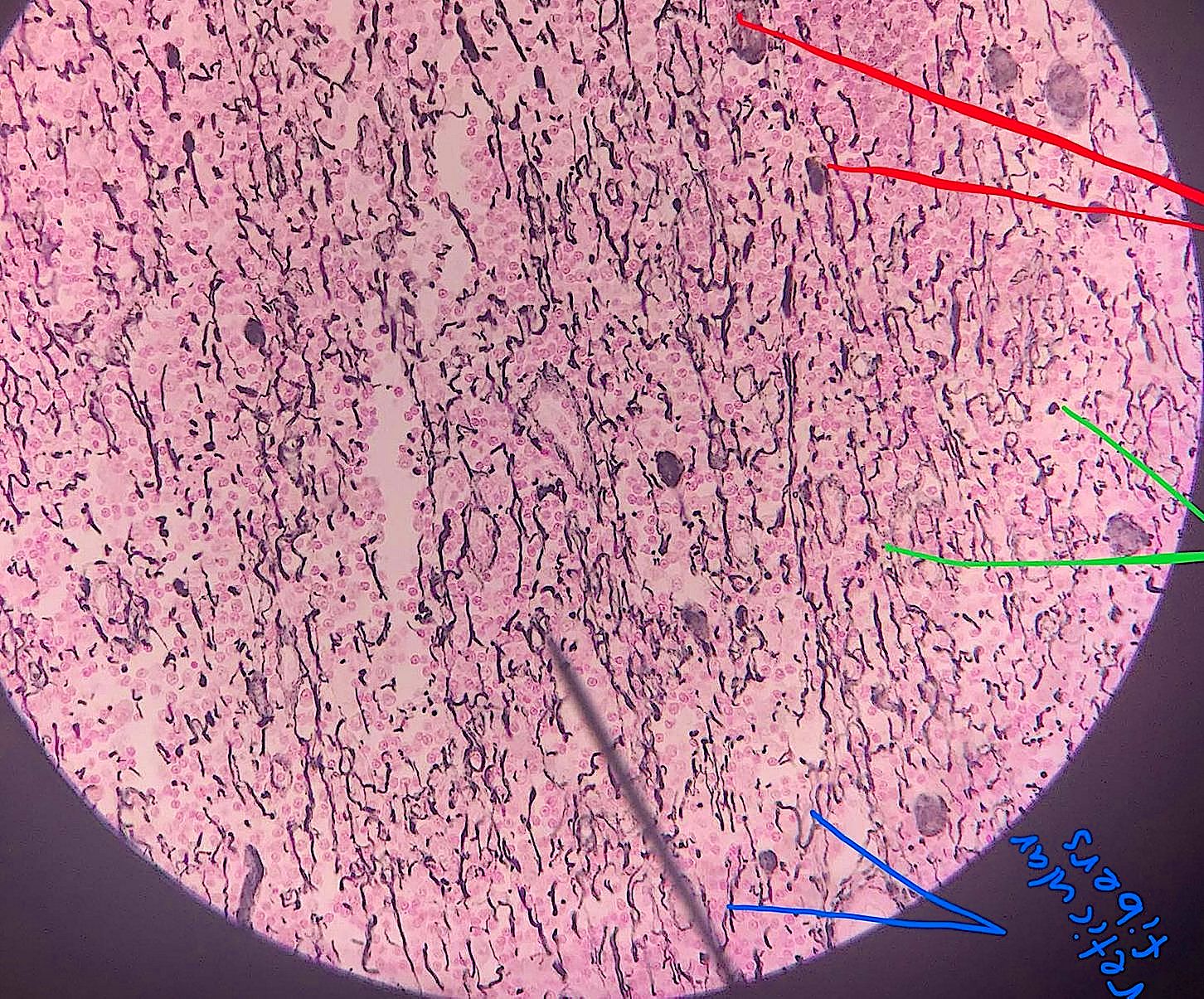 reticularconnective tissue