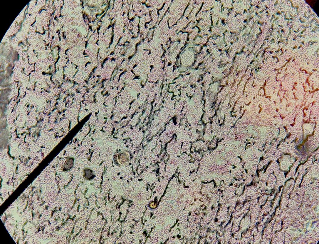 reticularconnective tissue