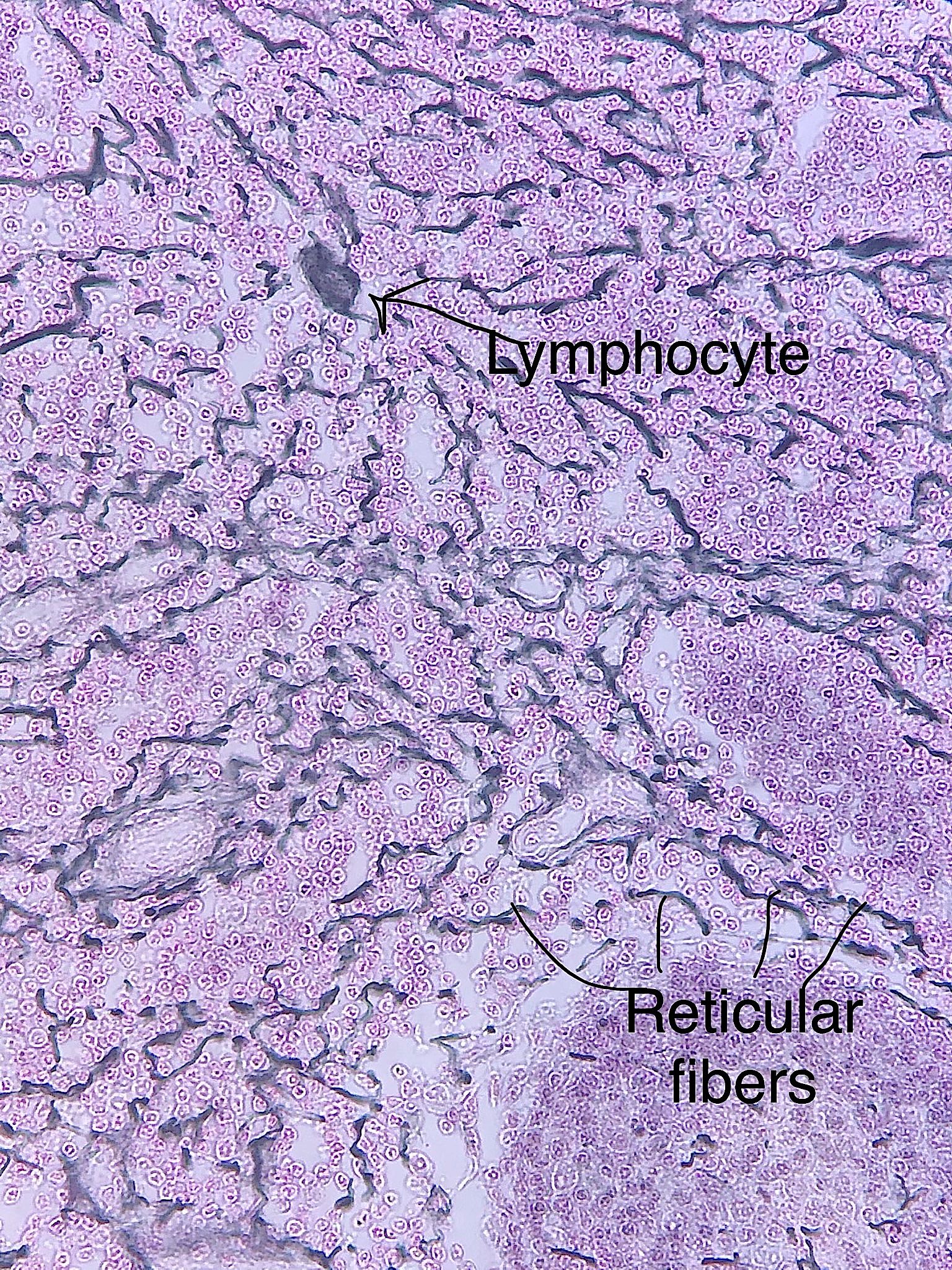 reticularconnective tissue