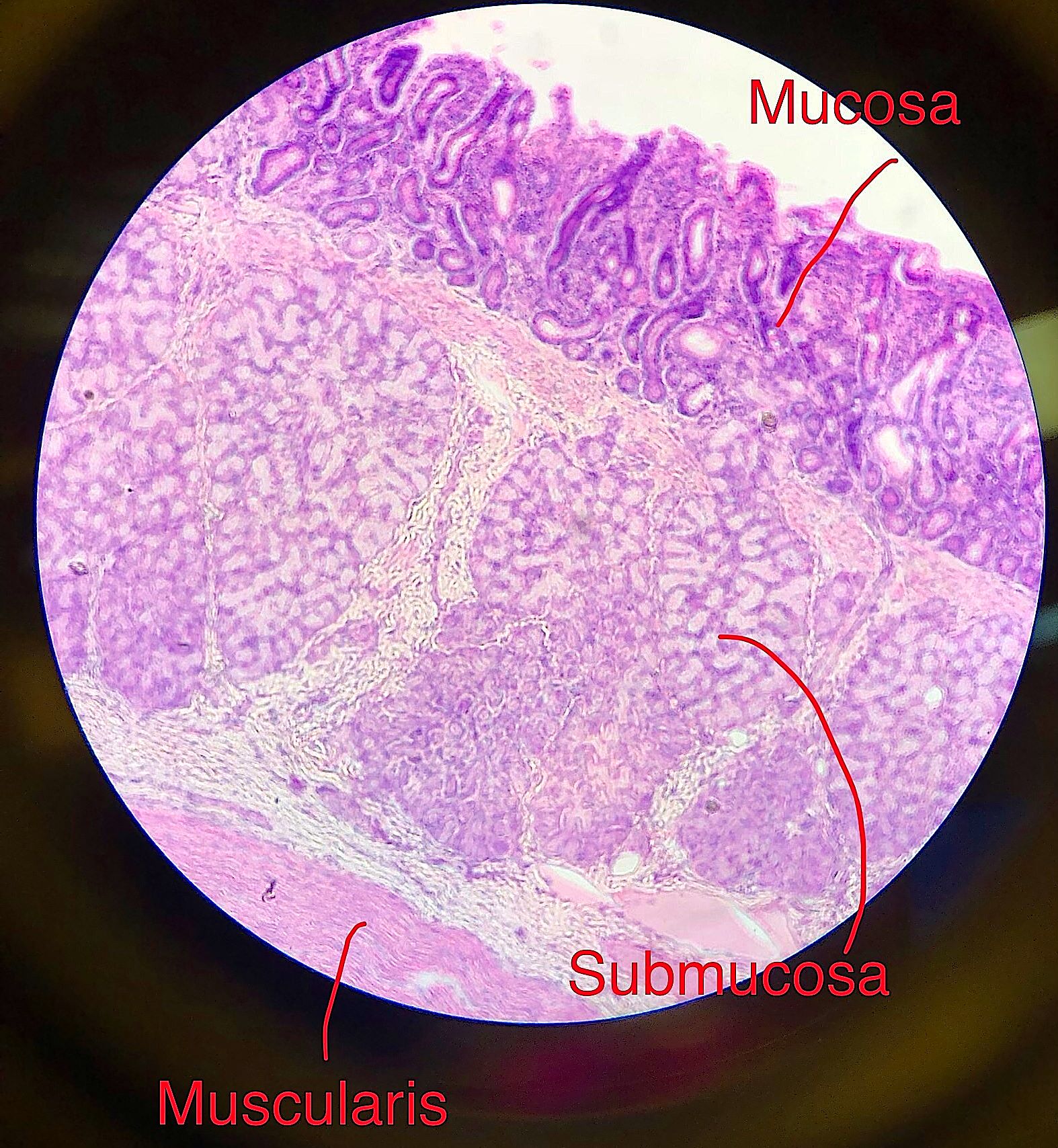 duodenum