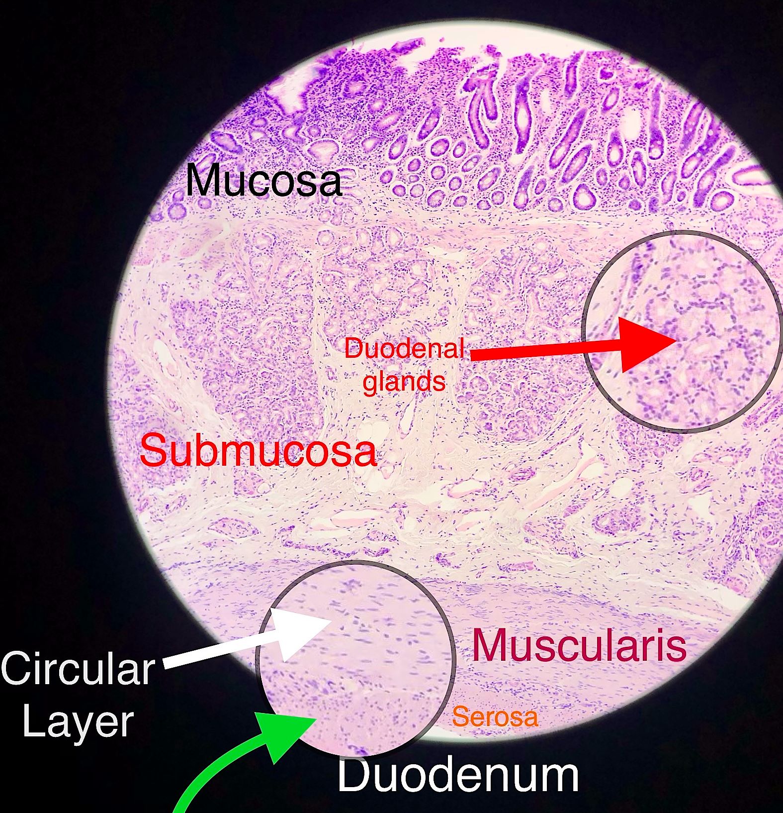 duodenum