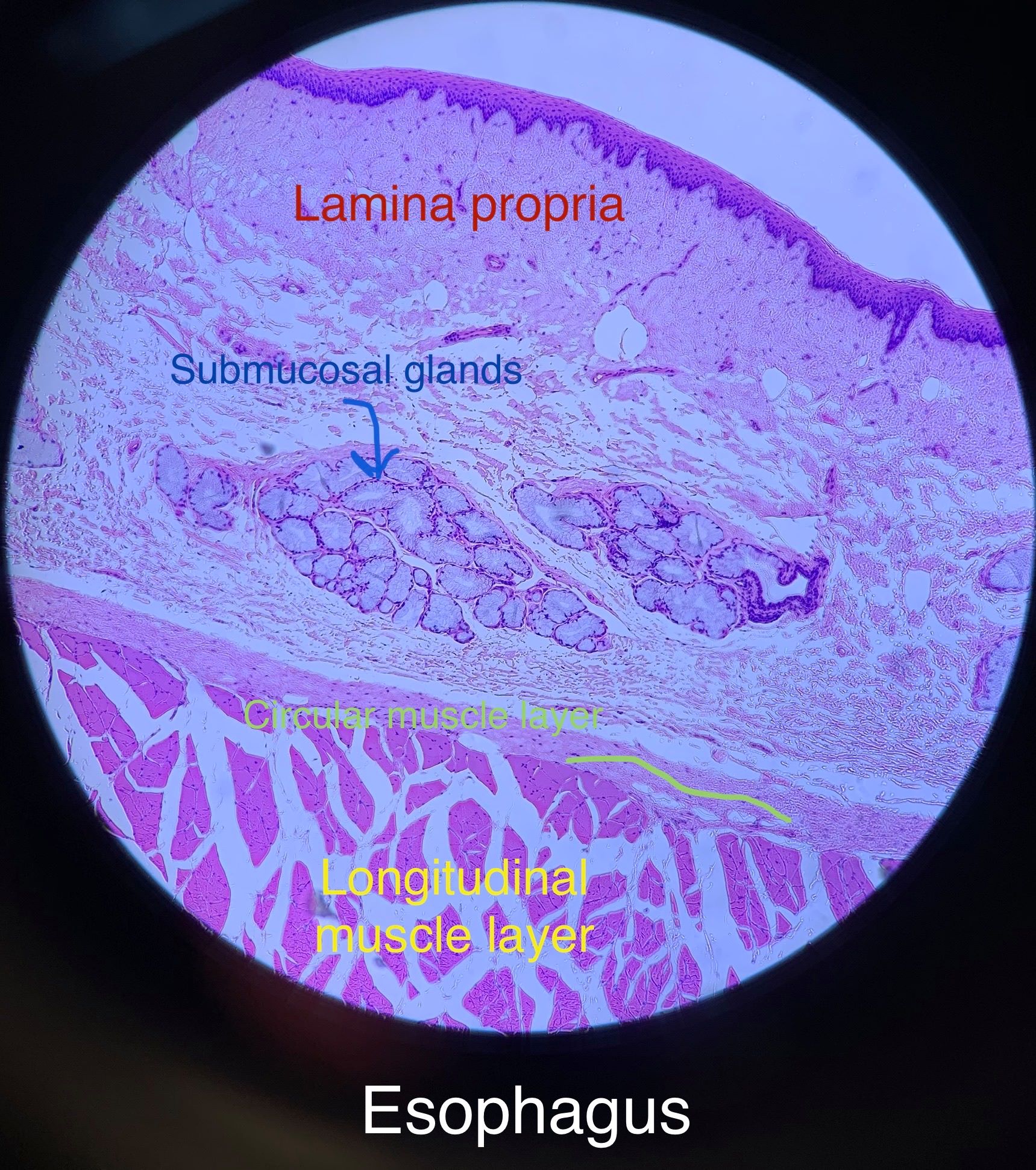 esophagus