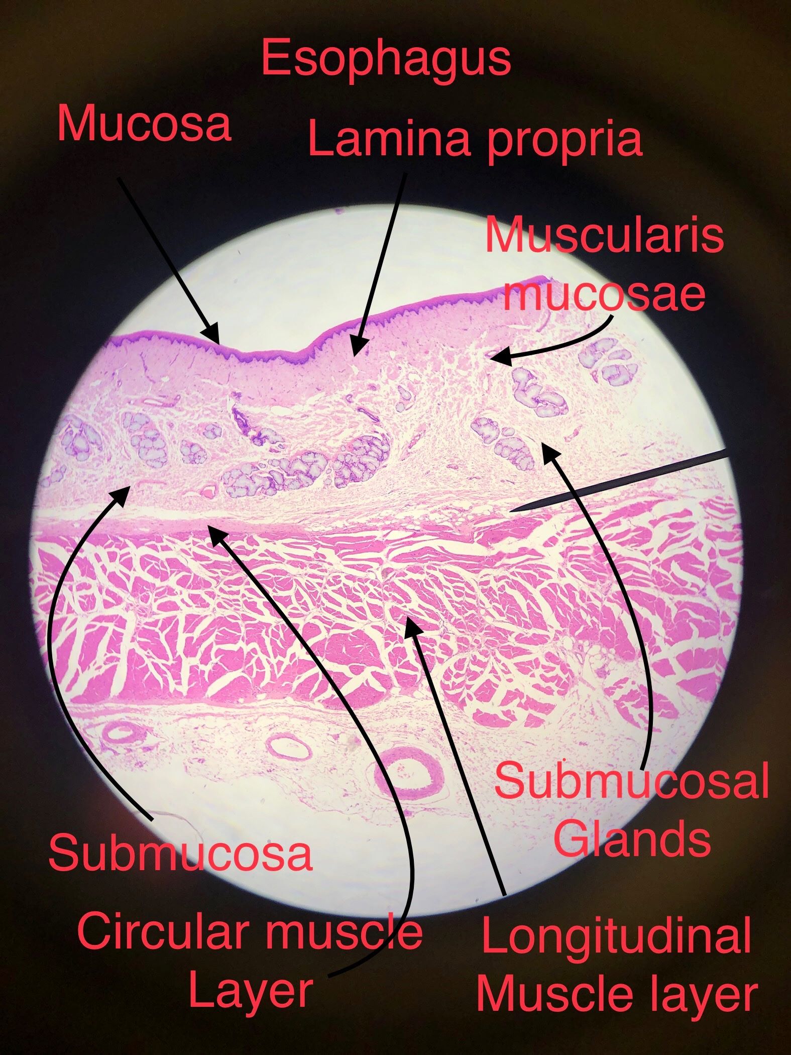 esophagus