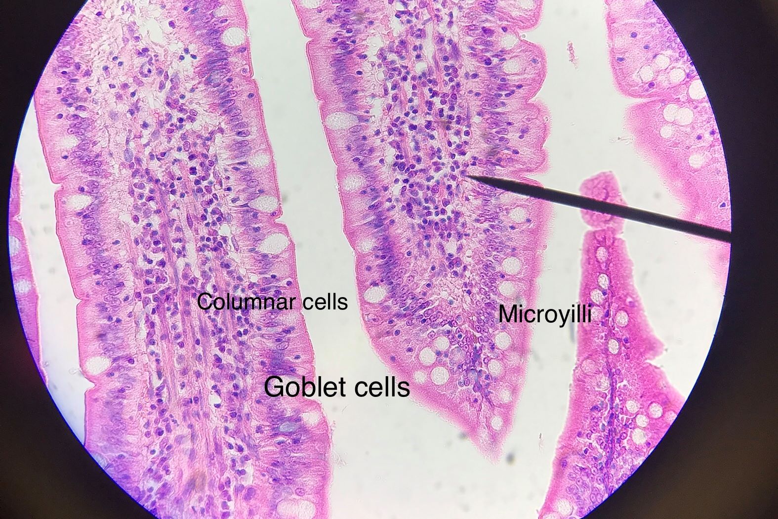 jejunum