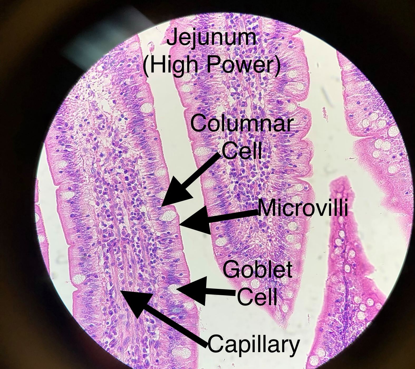 jejunum