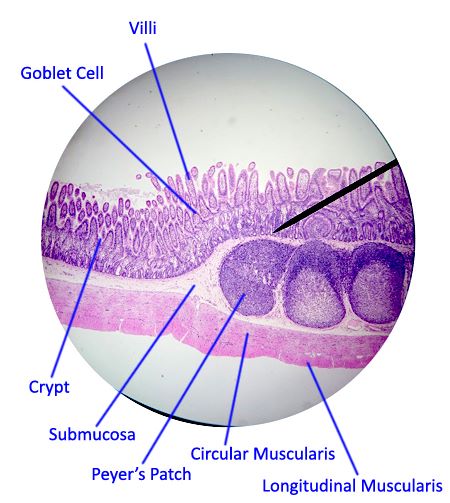 duodenum