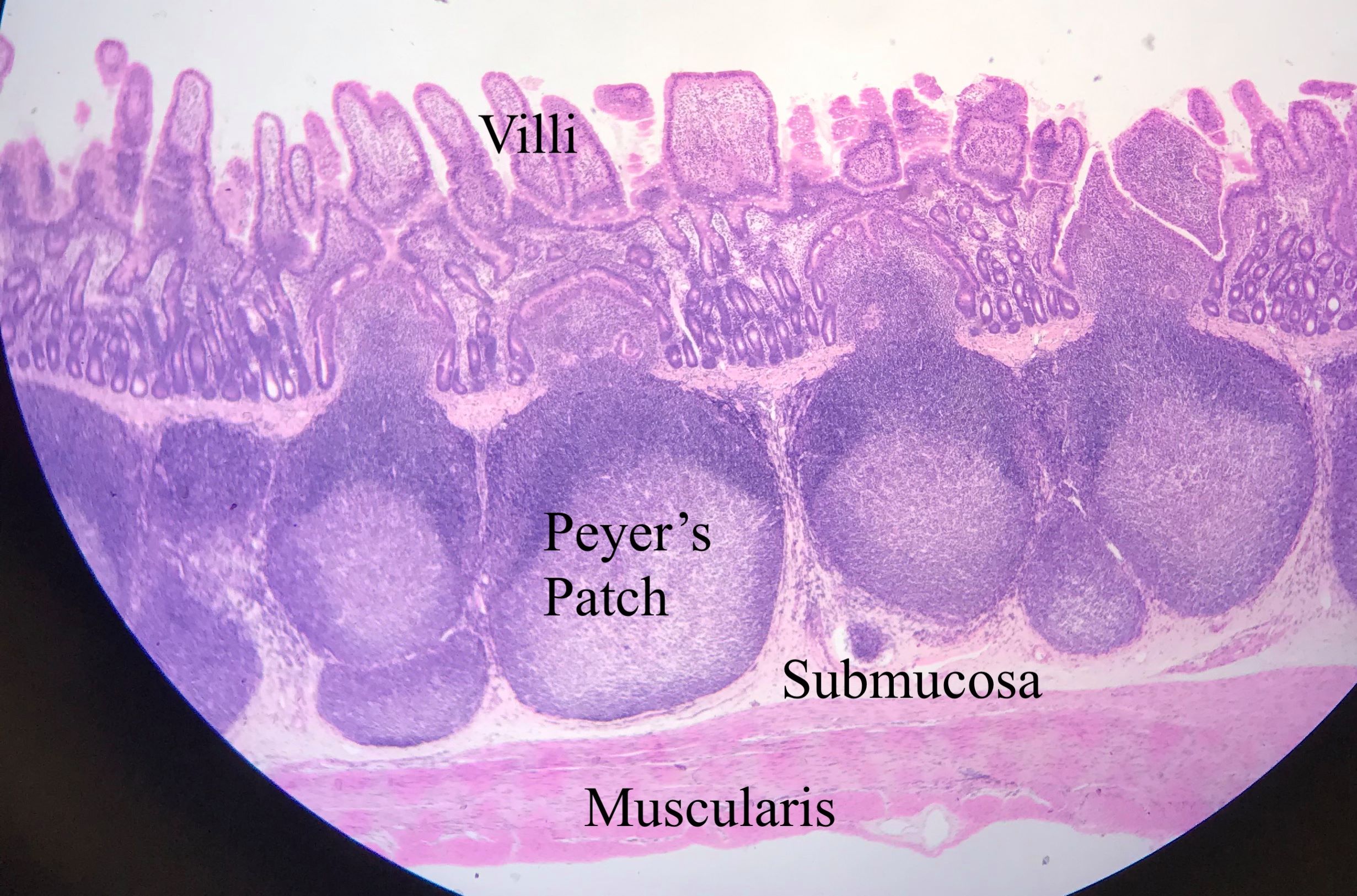 duodenum