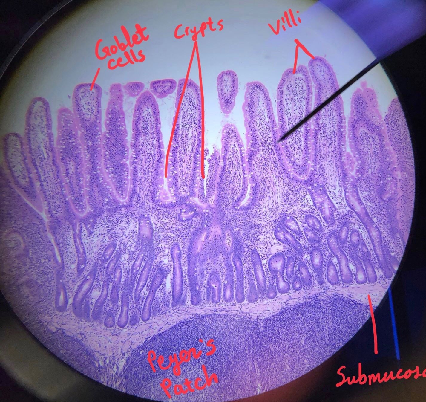 duodenum