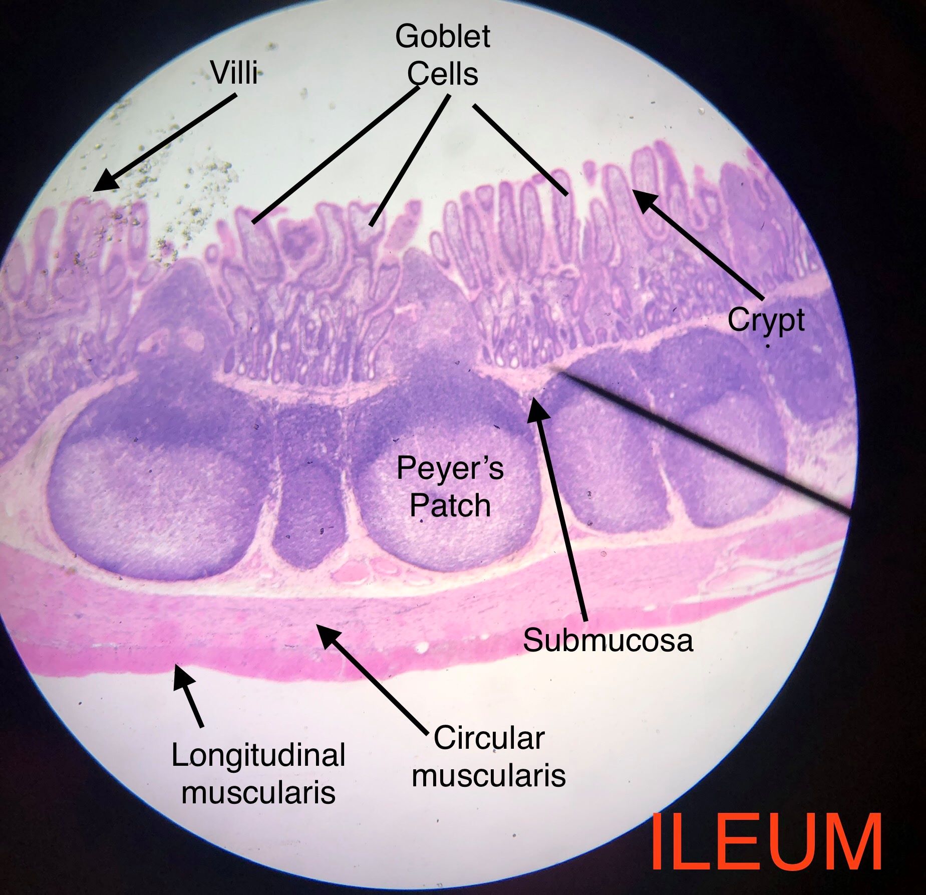 duodenum