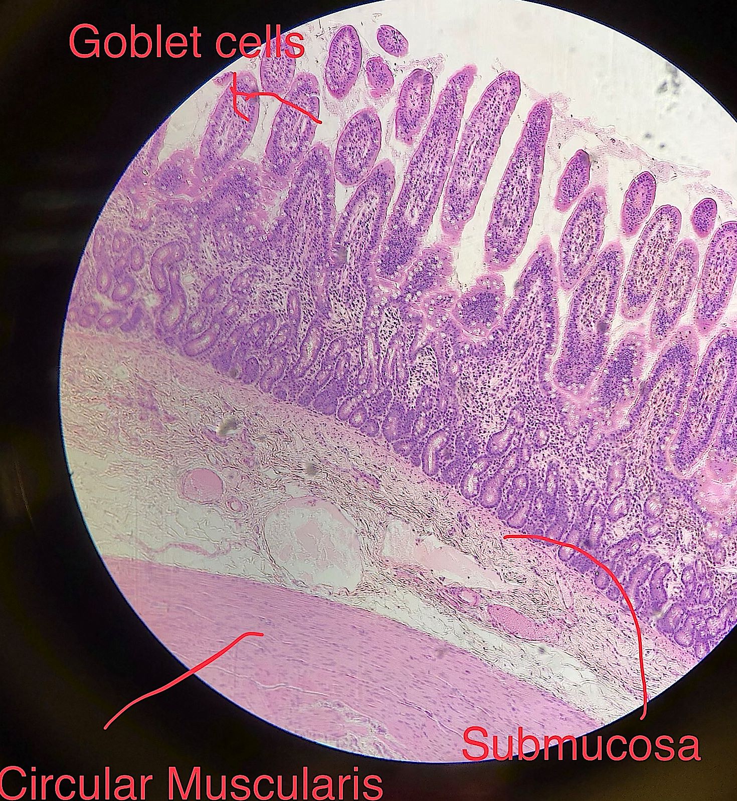 jejunum