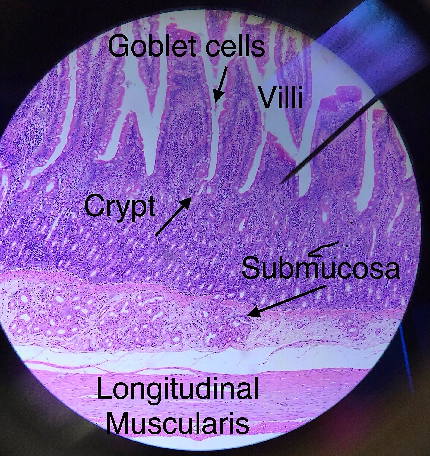 jejunum