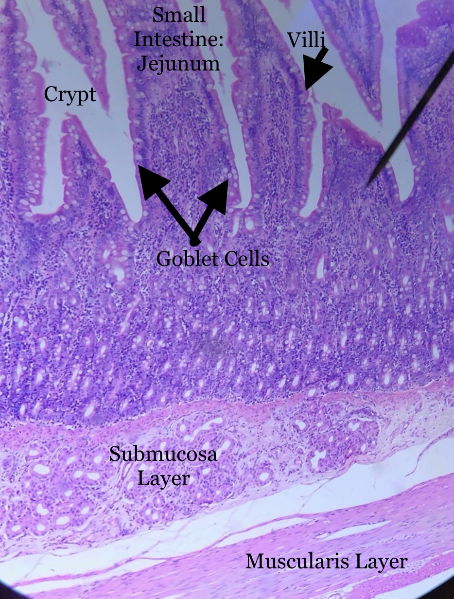 jejunum