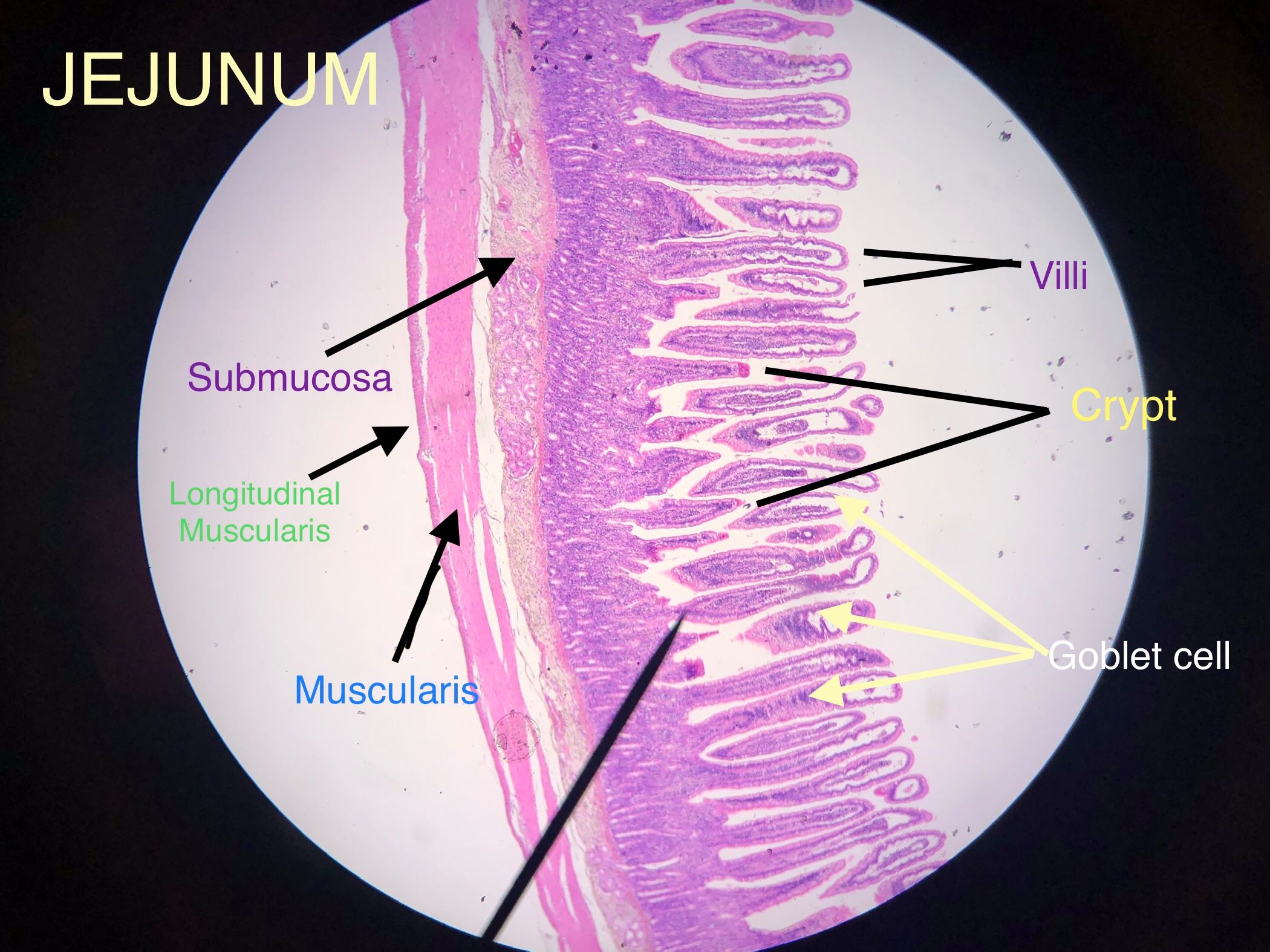 jejunum