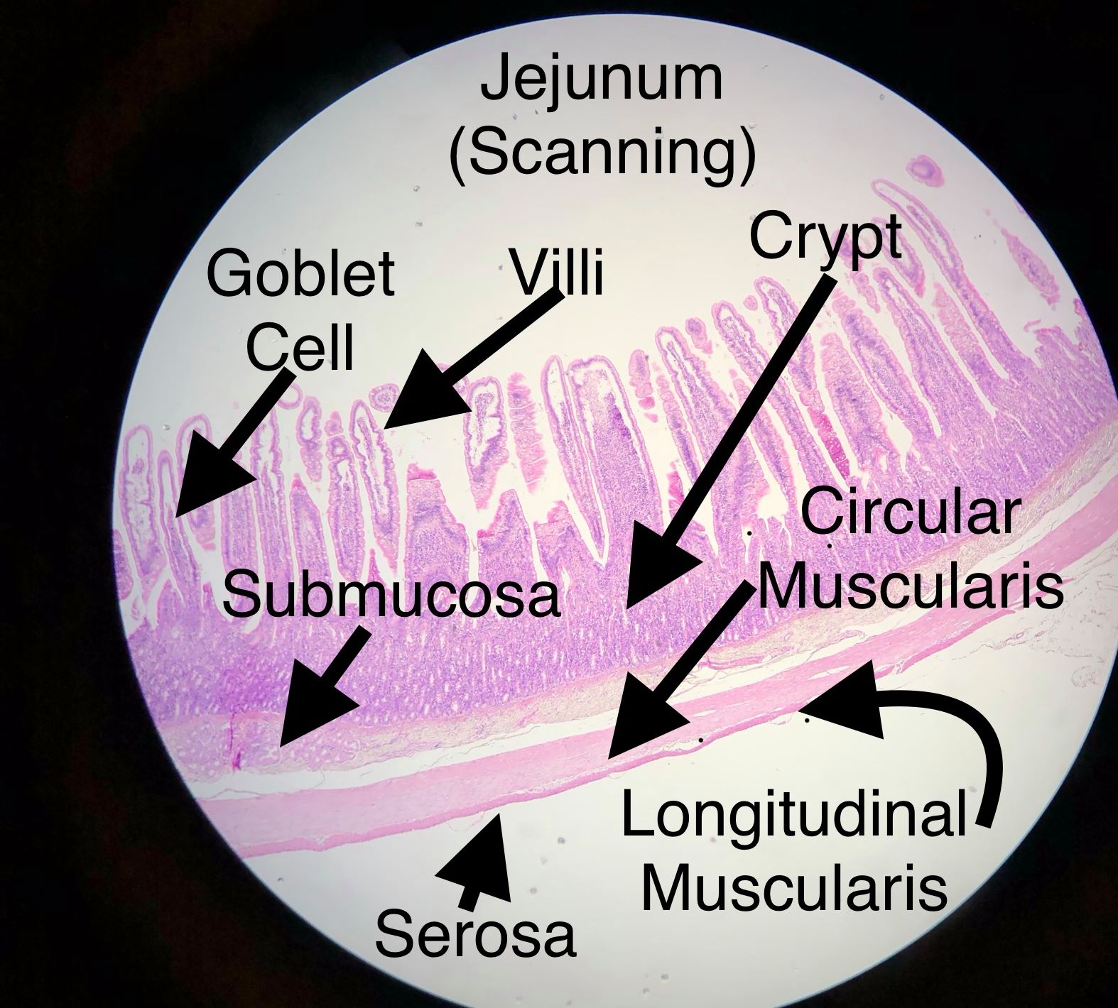 jejunum