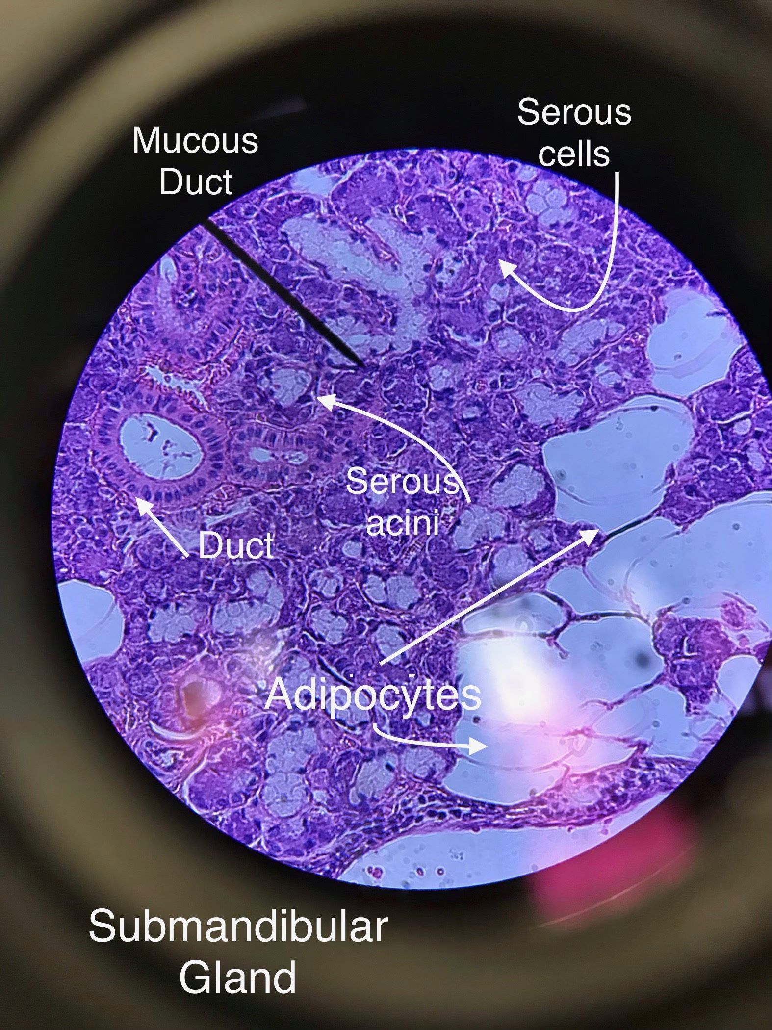 submandibular gland