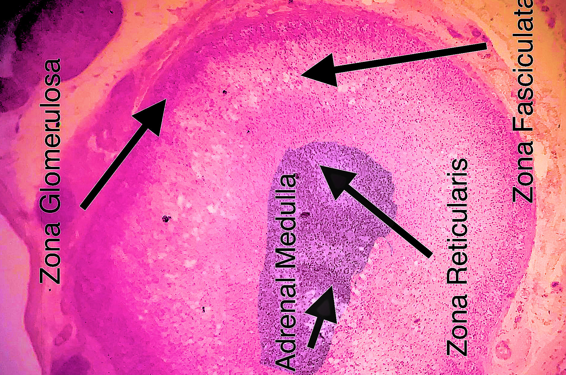 Adrenal Gland border=