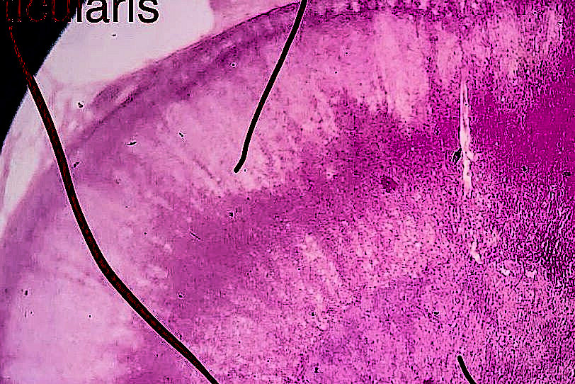 Adrenal Gland