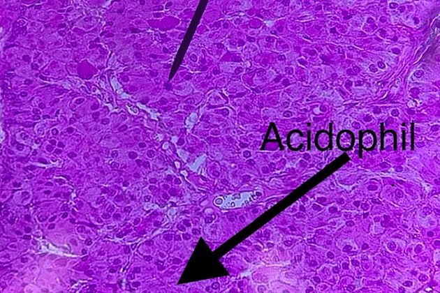 Pituitary low