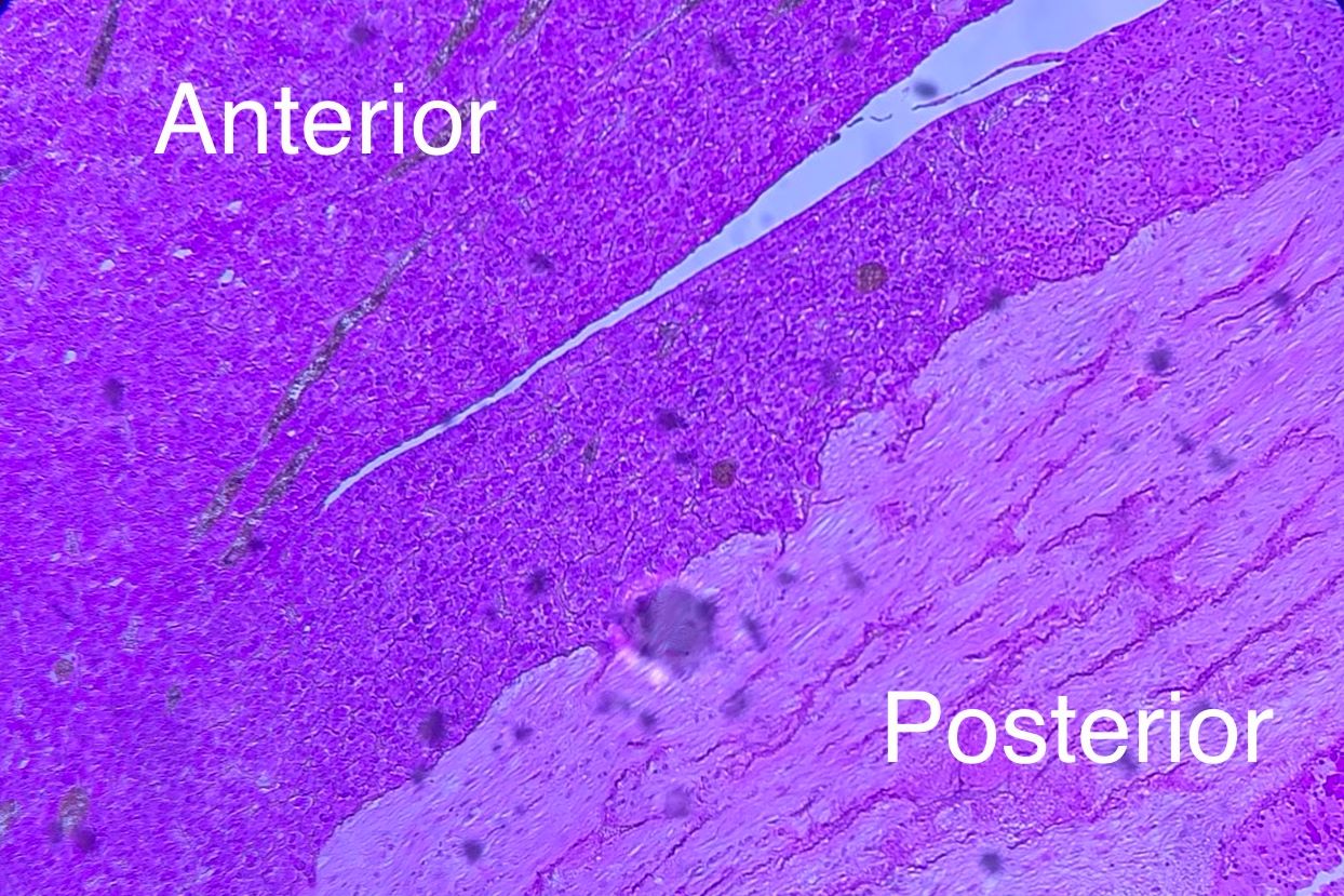 Pituitary low