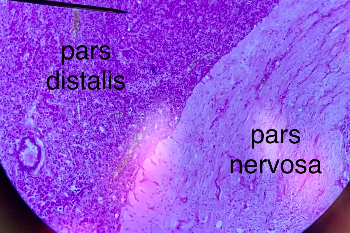 Pituitary low