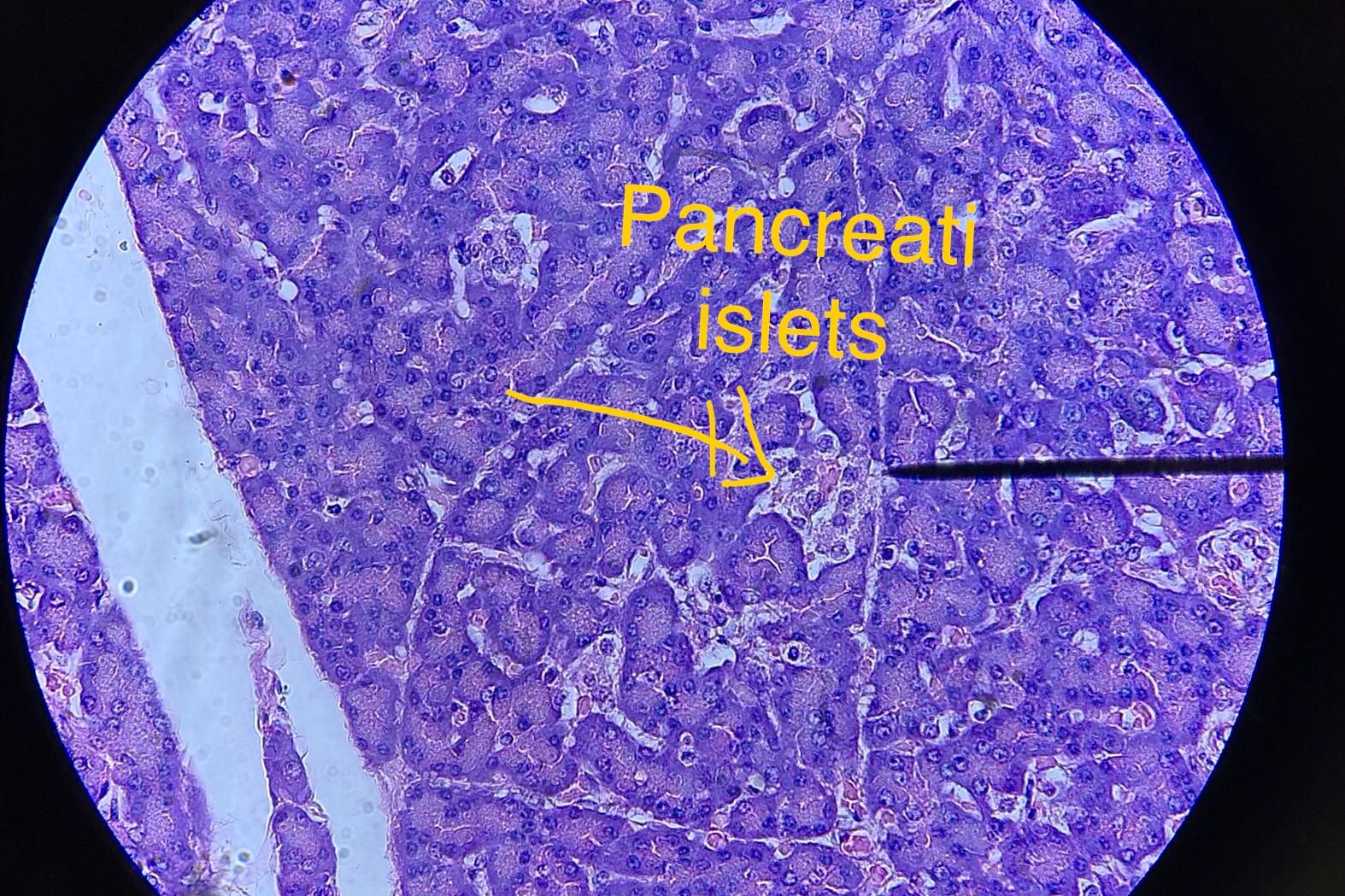 Thyroid Gland