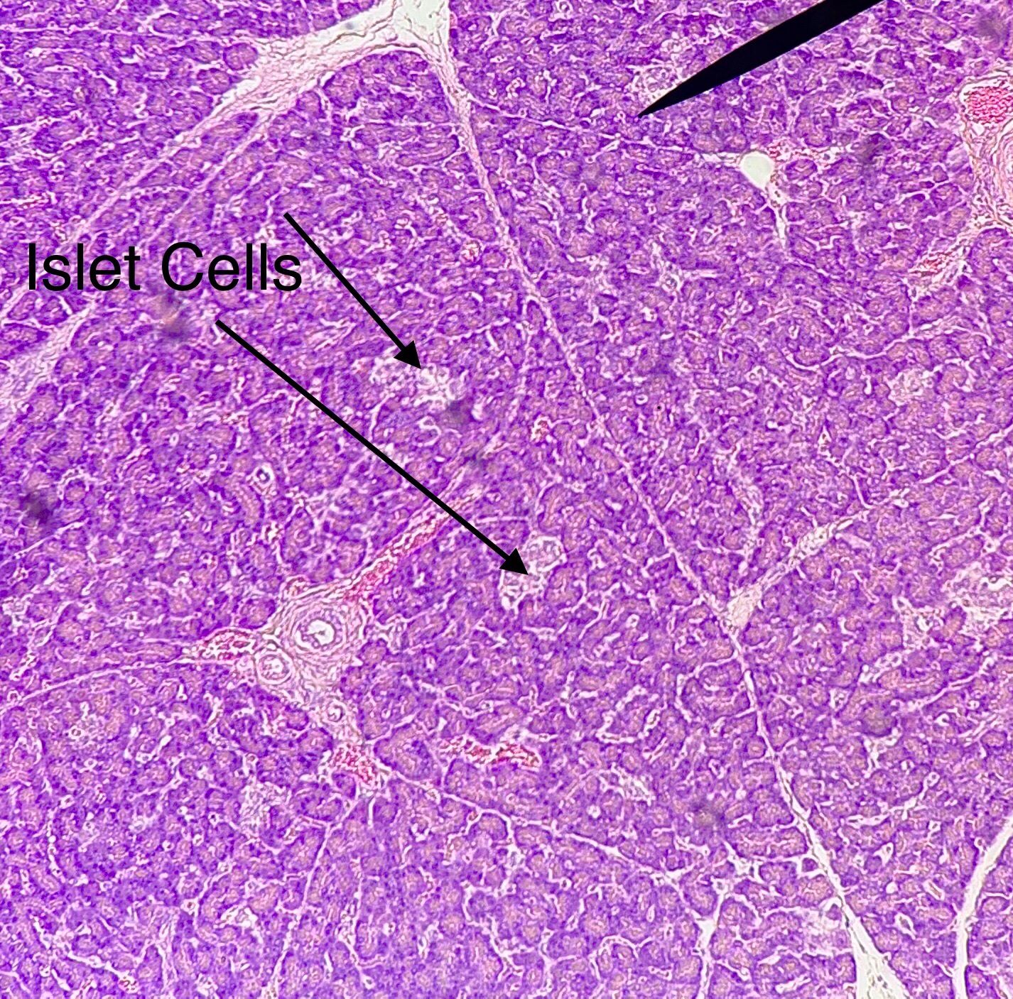 Thyroid  Gland