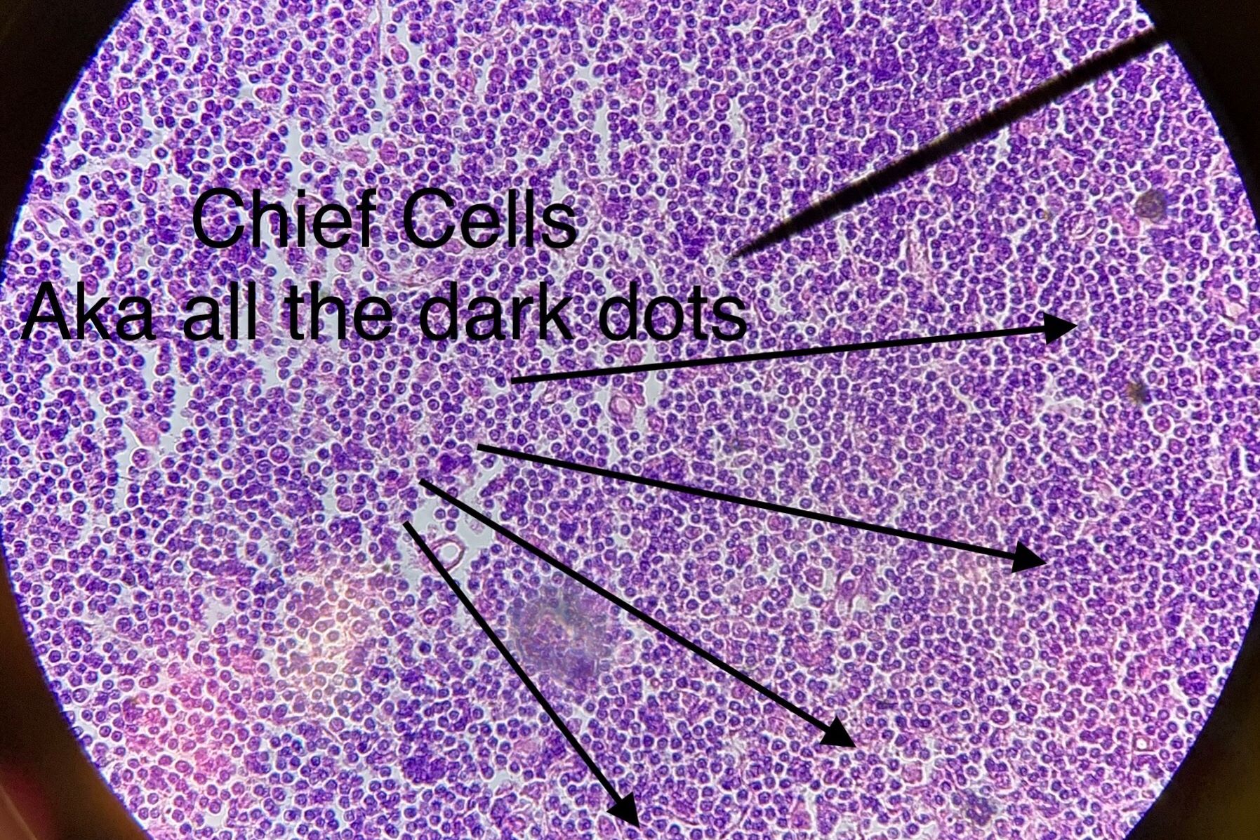 parathyroid Gland