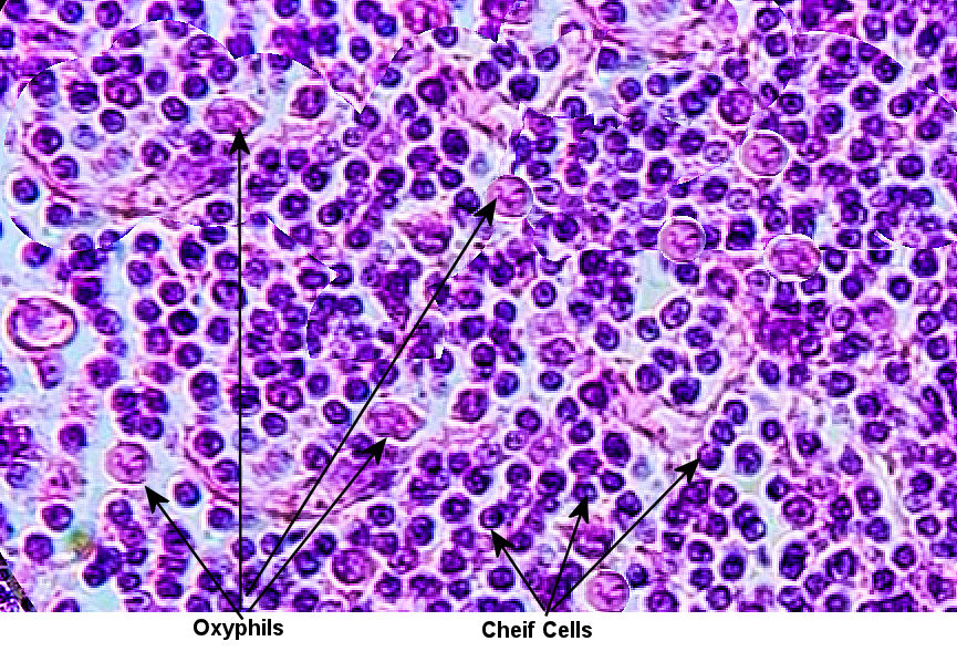 parahyroid  Gland