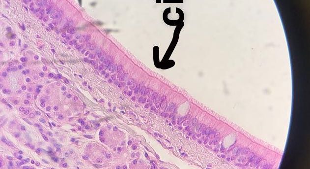 pseudostratified columnar epithelium