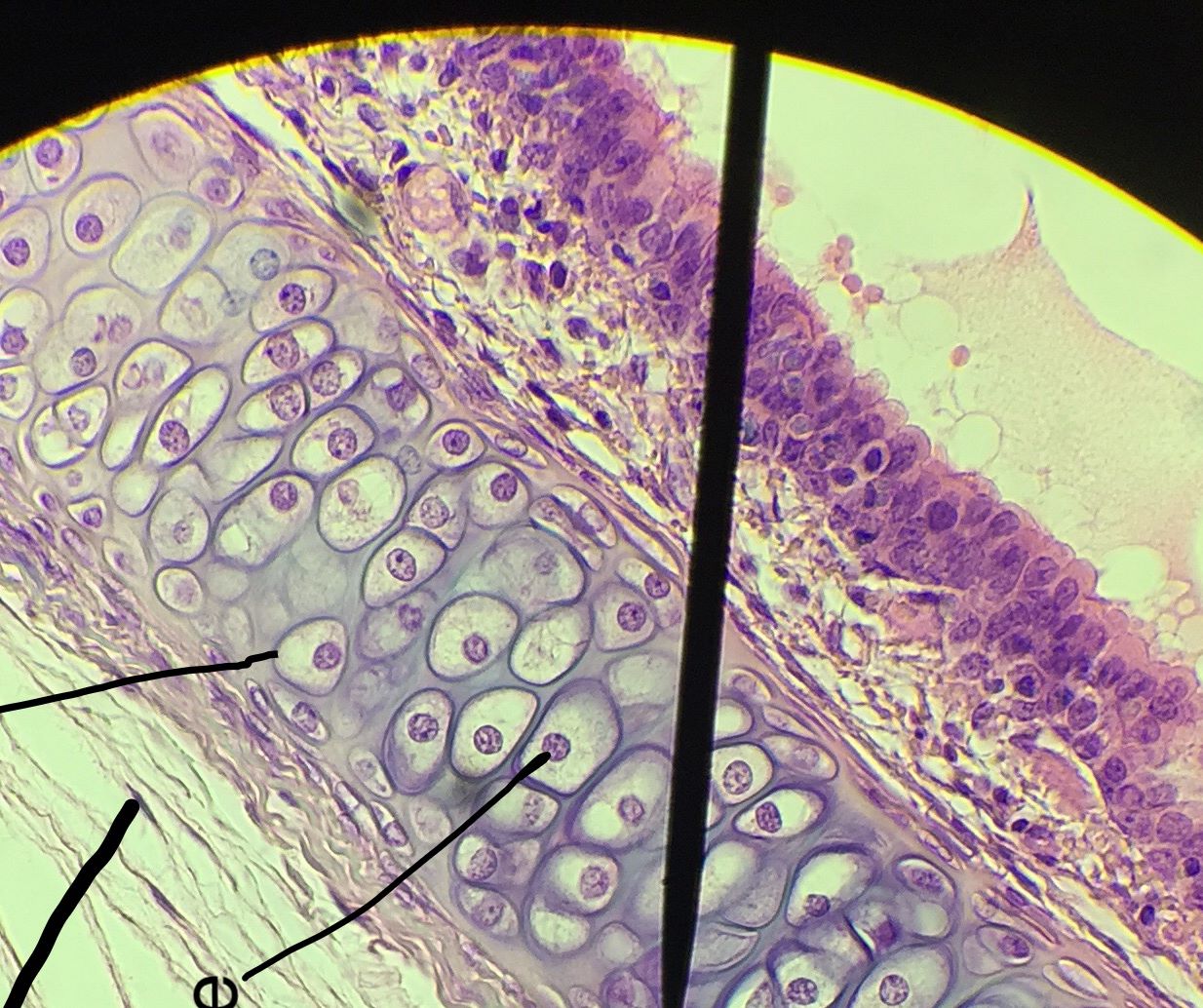 pseudostratified columnar epithelium