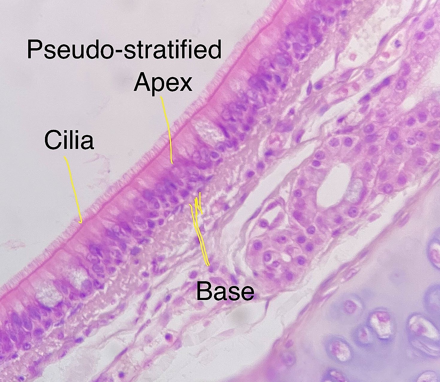 pseudostratified columnar epithelium