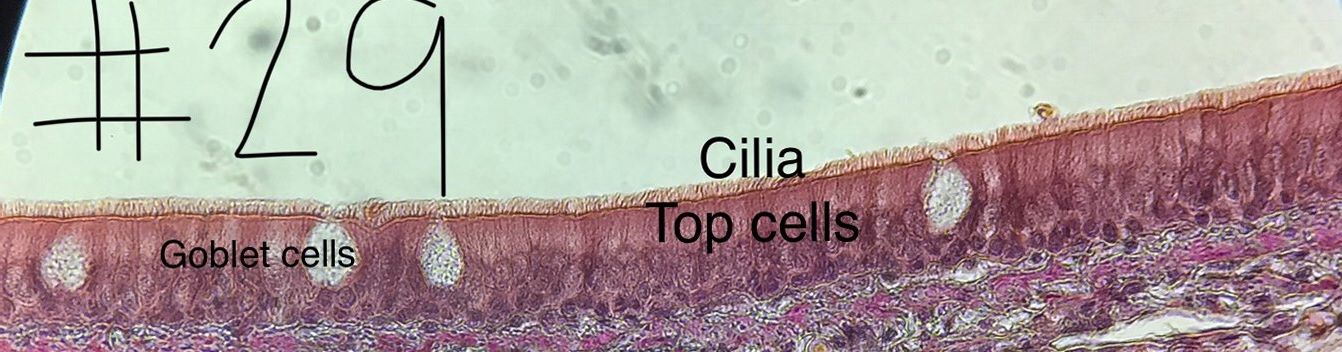 pseudostratified columnar epithelium