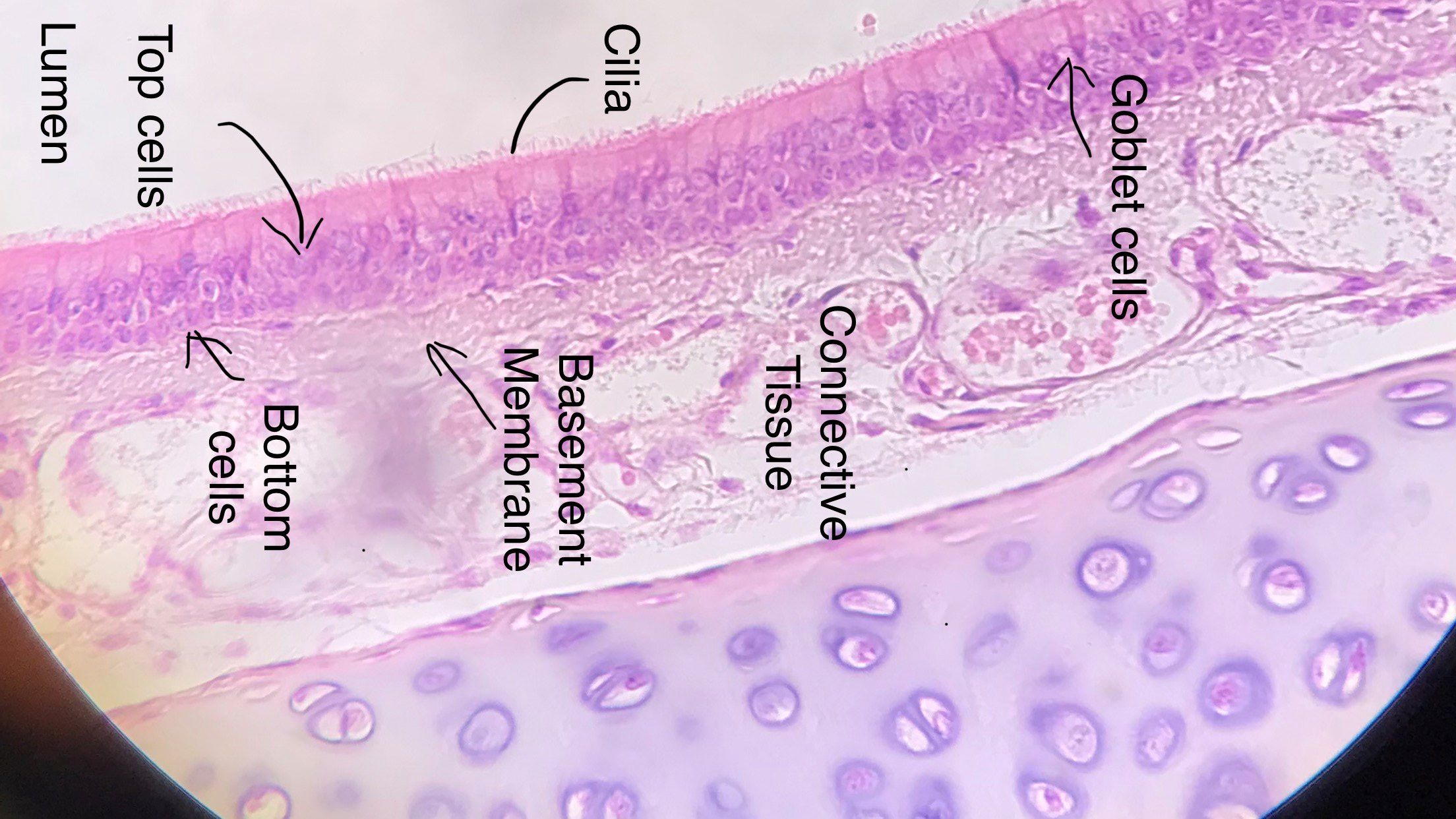 pseudostratified columnar epithelium