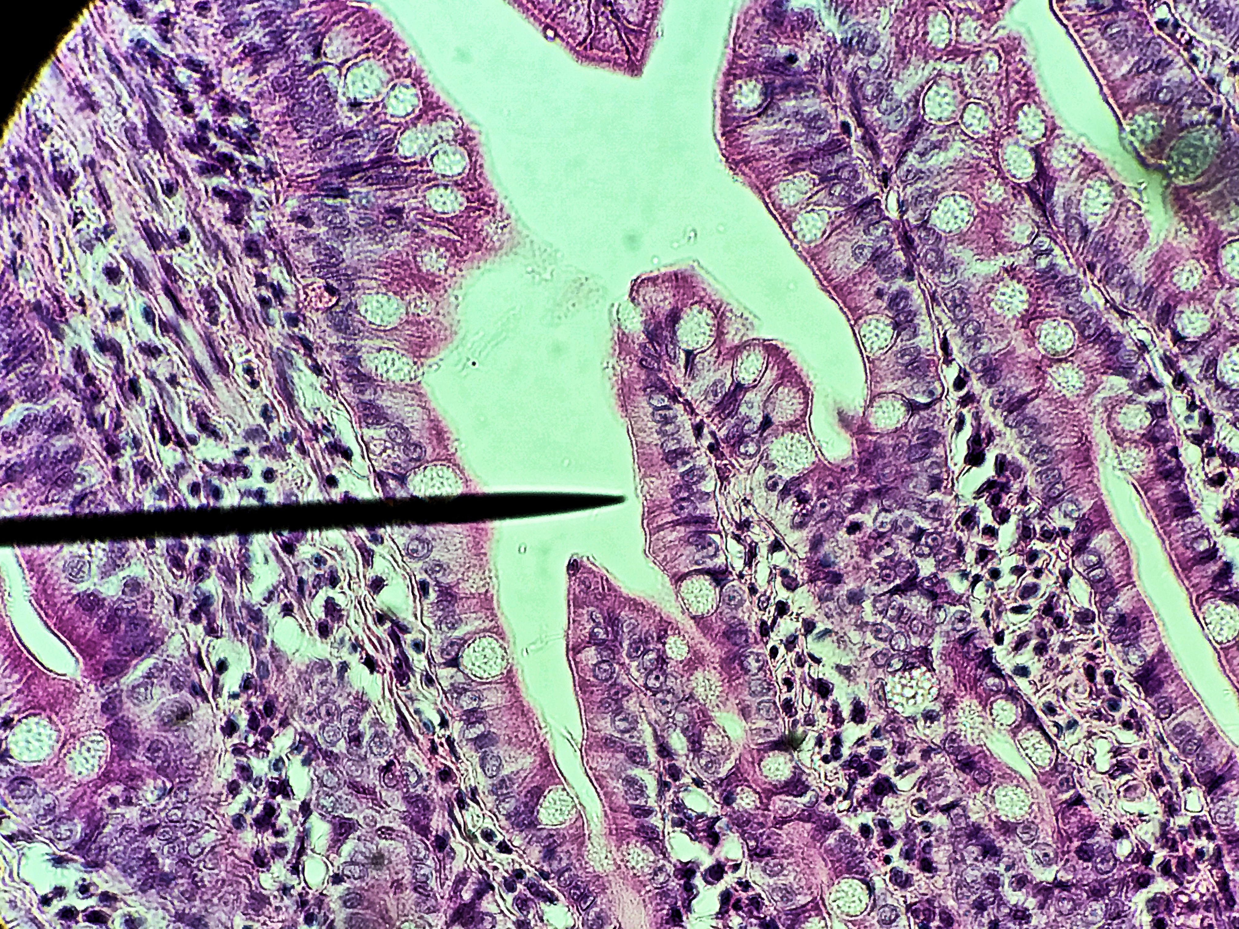 Simple columnar epithelium