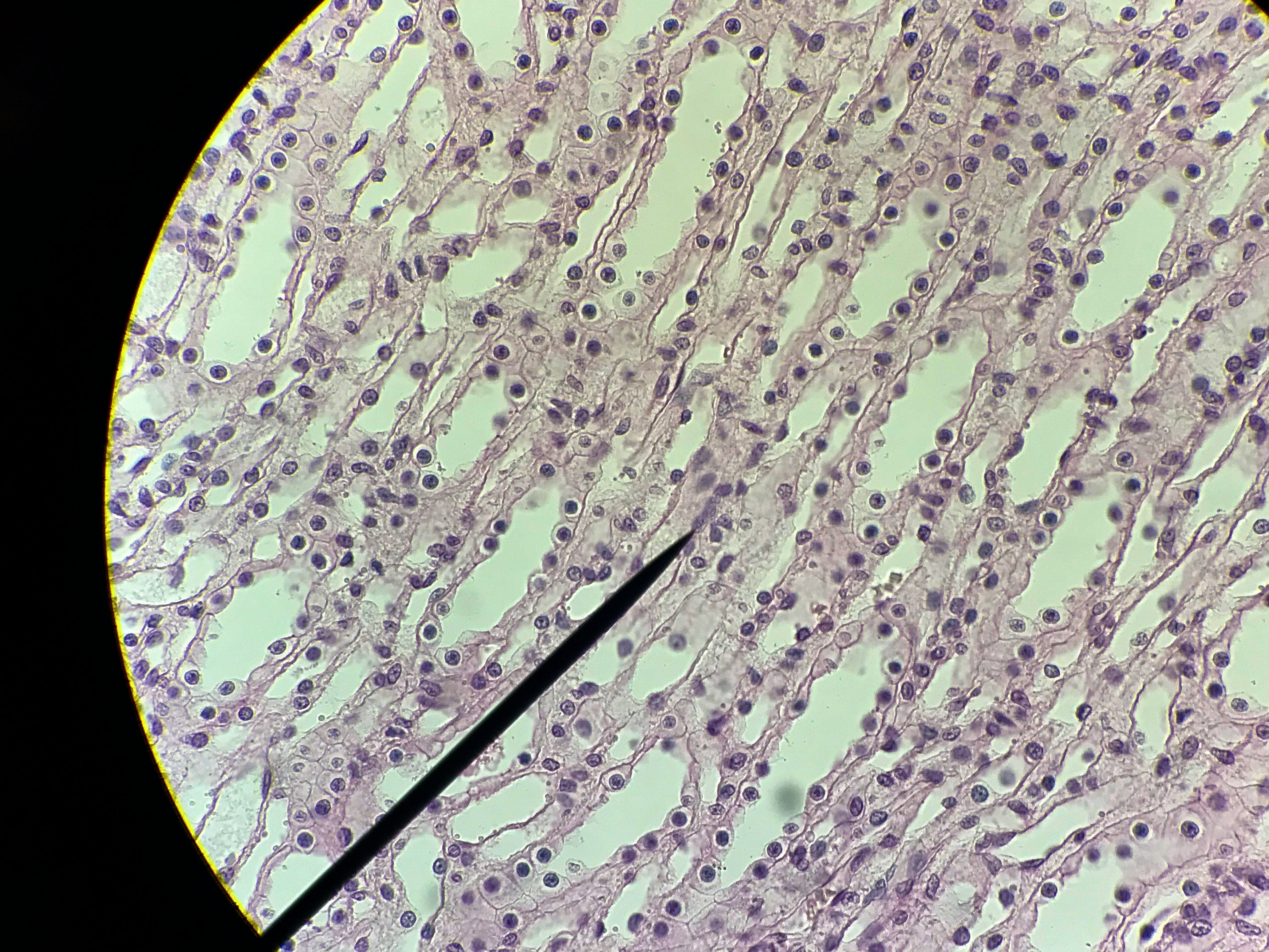 Simple cuboidal epithelium