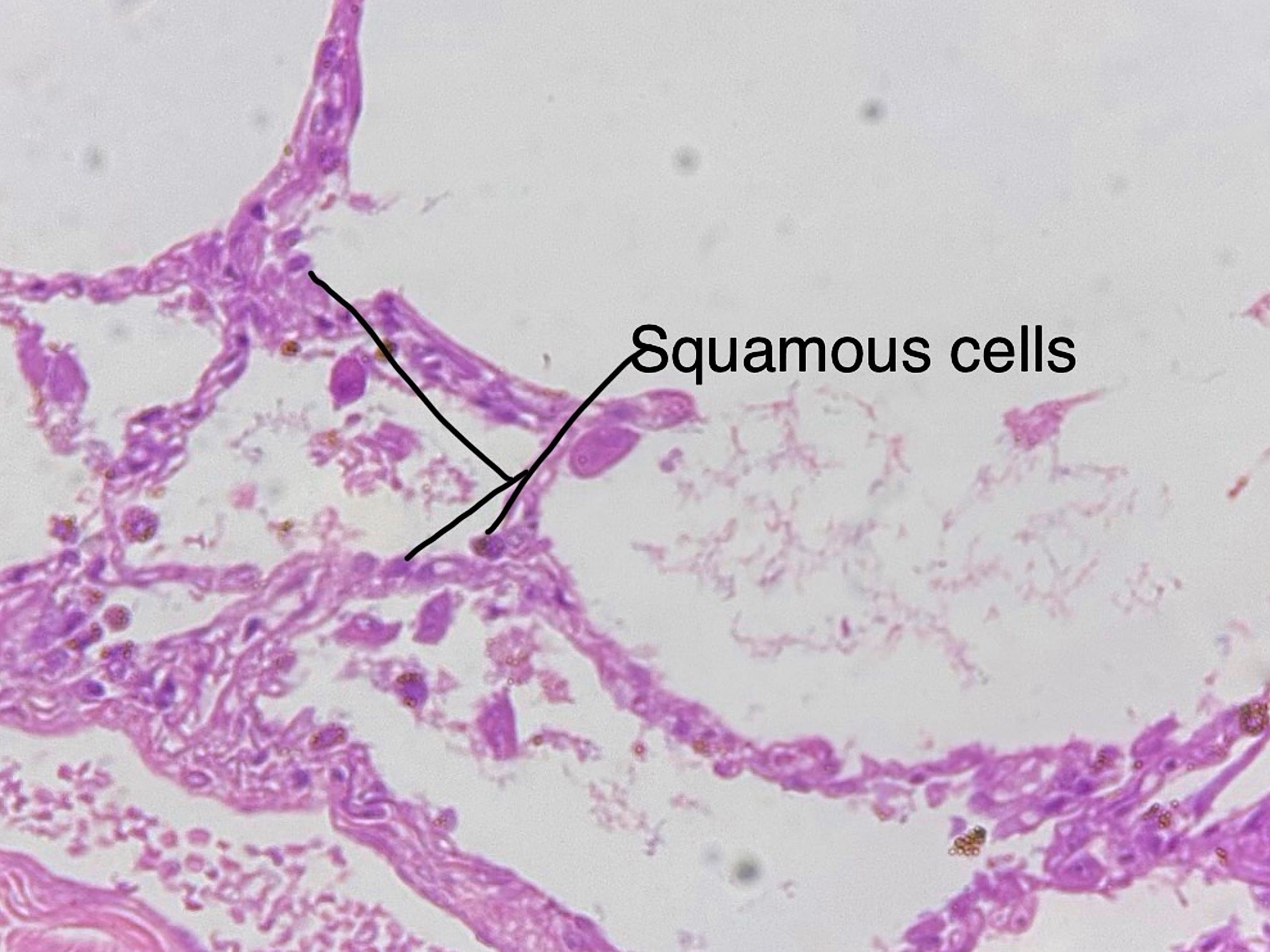 Simple squamous epithelium