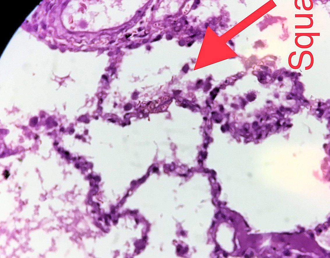 Simple squamous epithelium