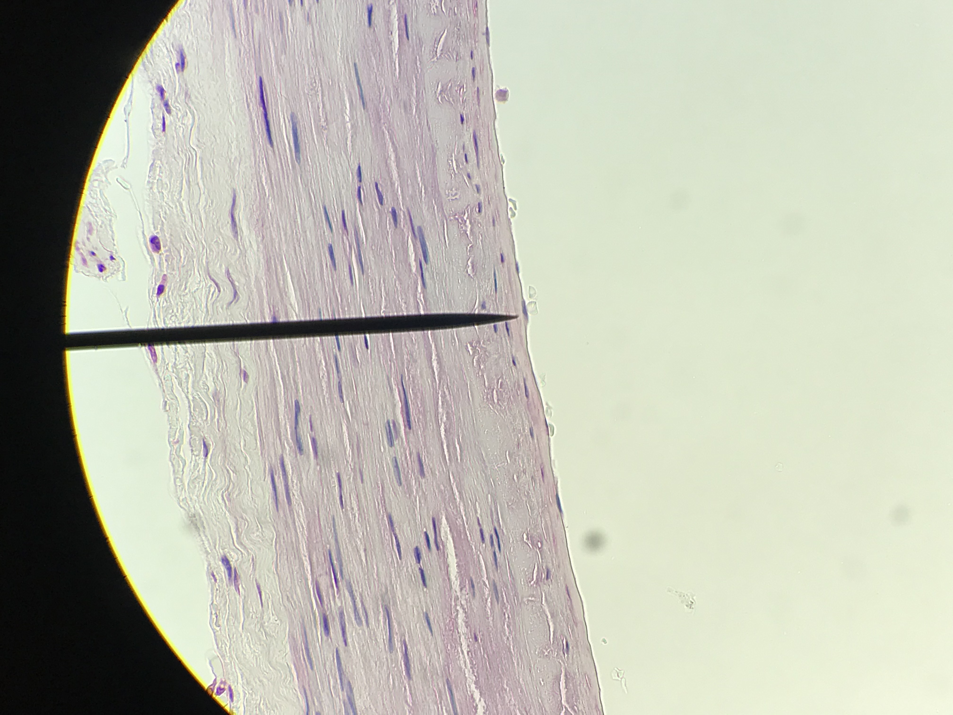 Simple squamous epithelium