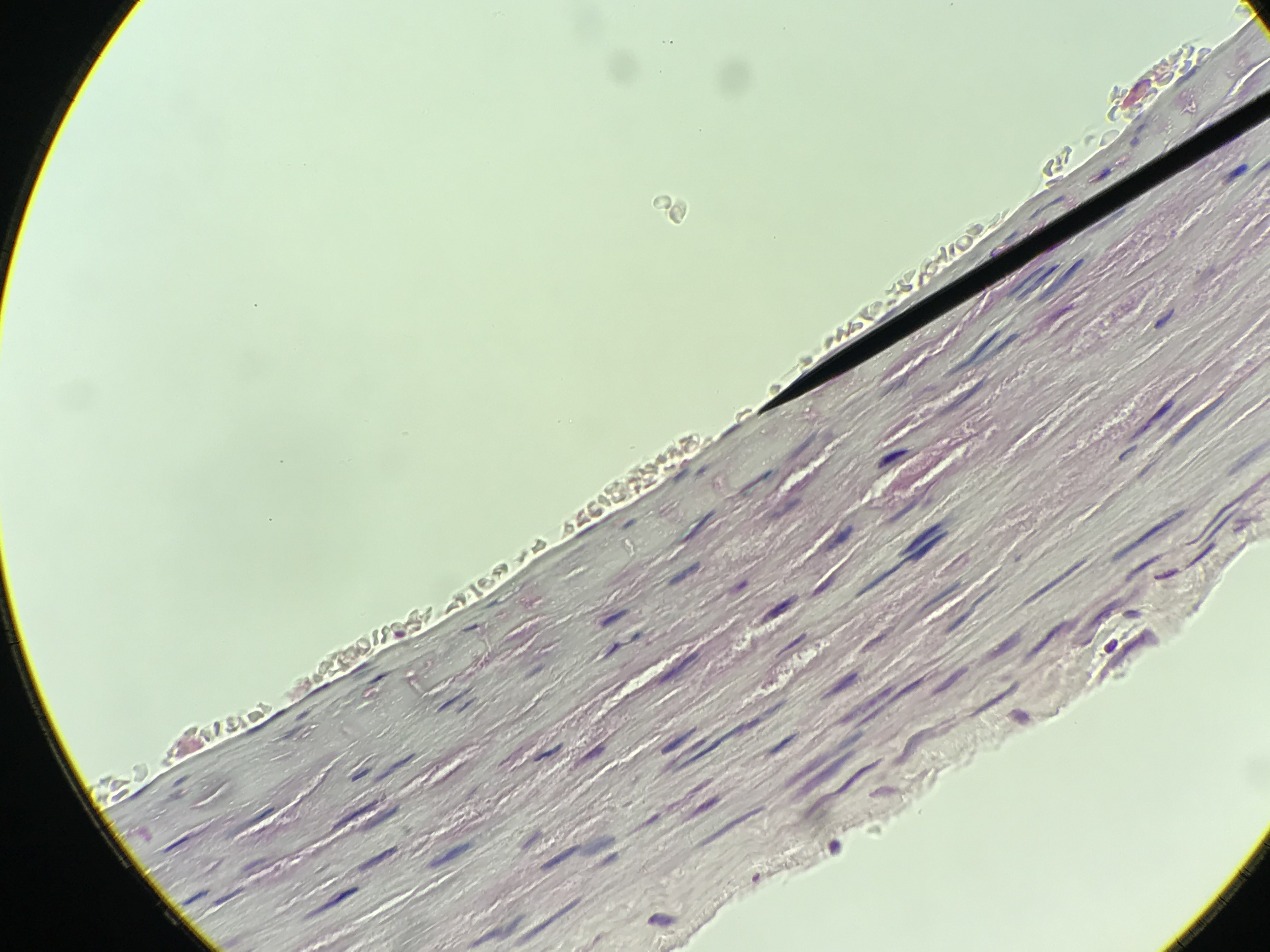 Simple squamous epithelium