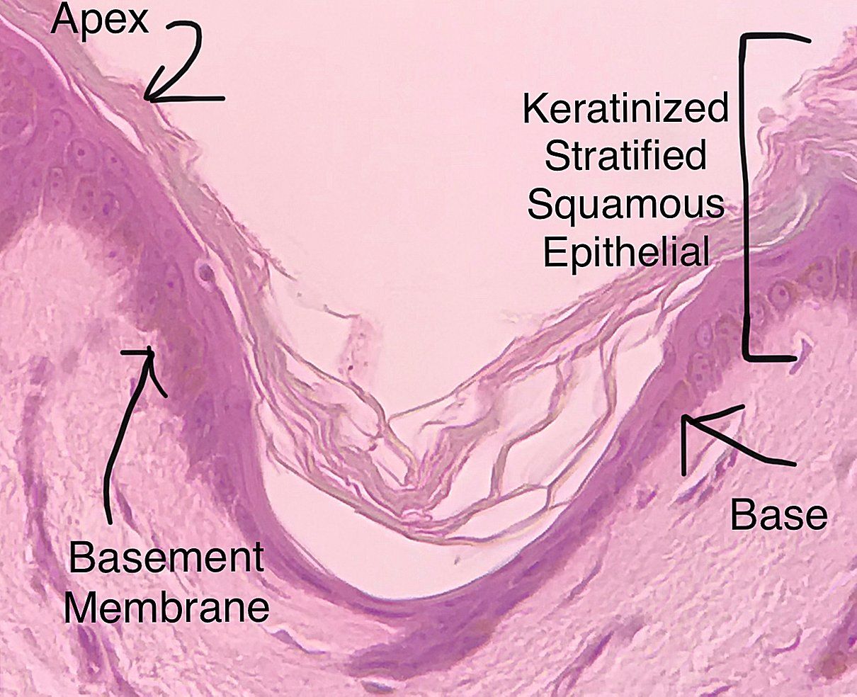 stratified squamous epithelium