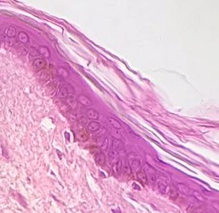 stratified squamous epithelium