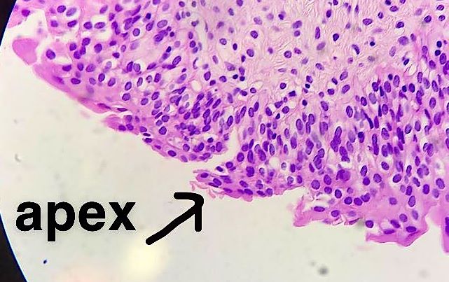 transitional epithelium