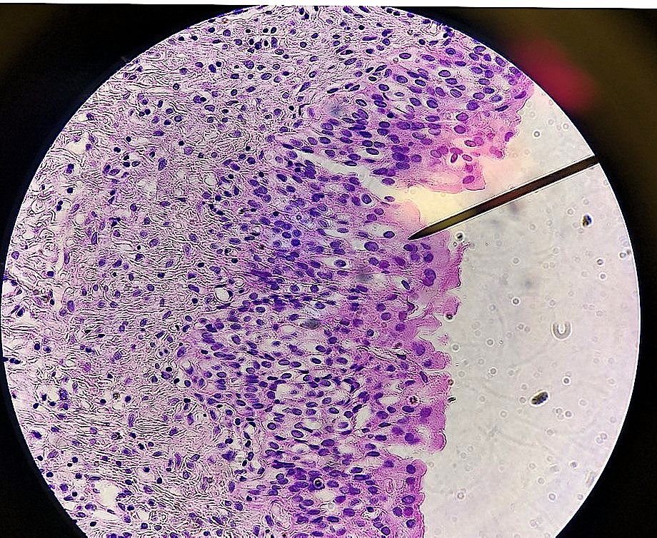 transitional epithelium