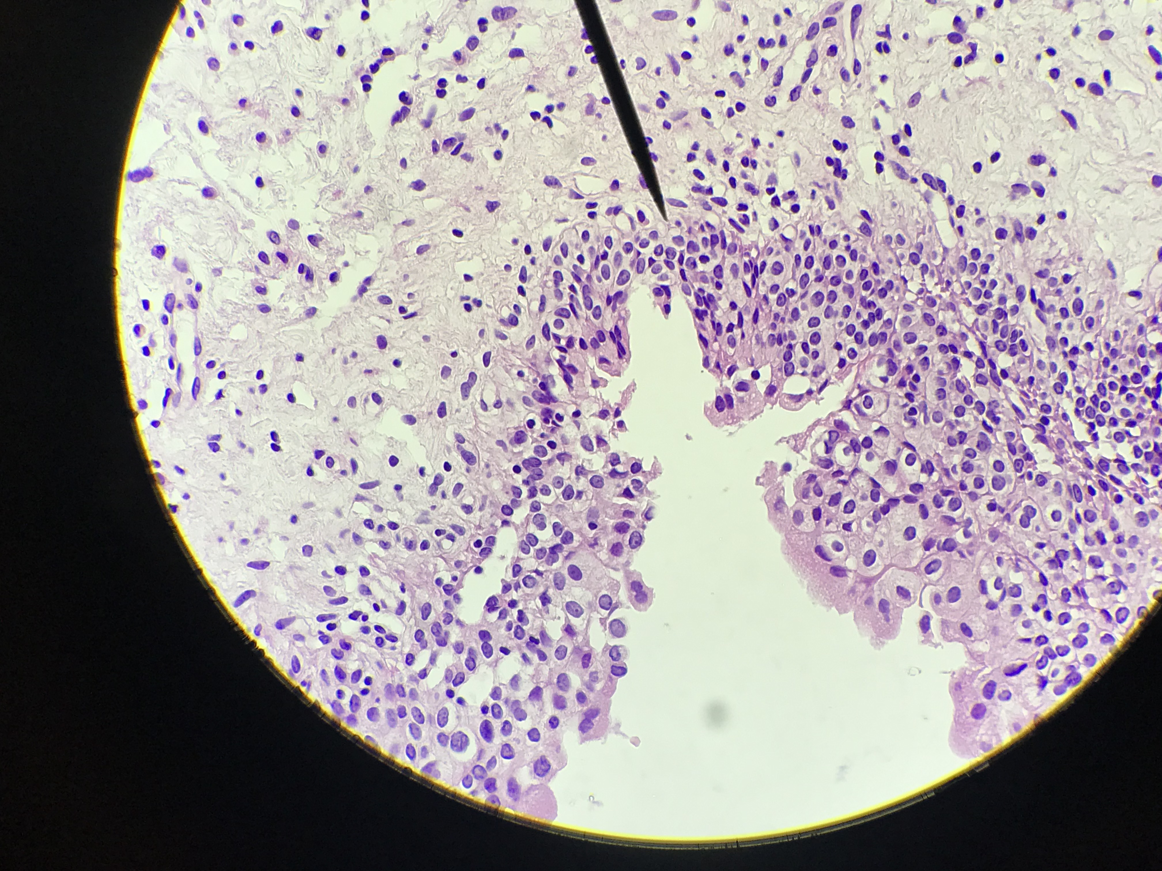 transitional epithelium