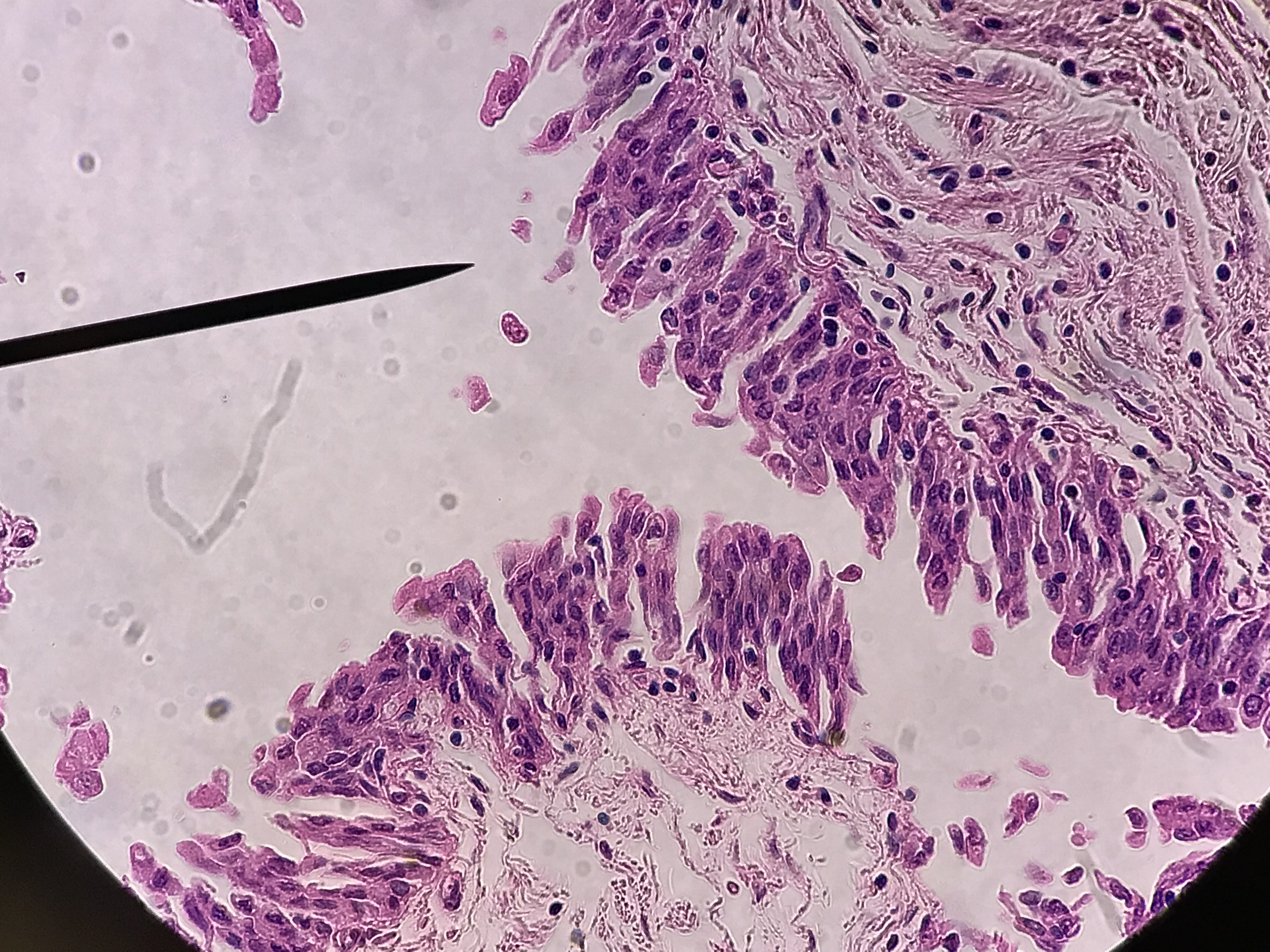 transitional epithelium