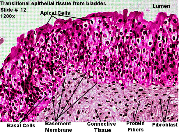 transitional epithelium Labeled