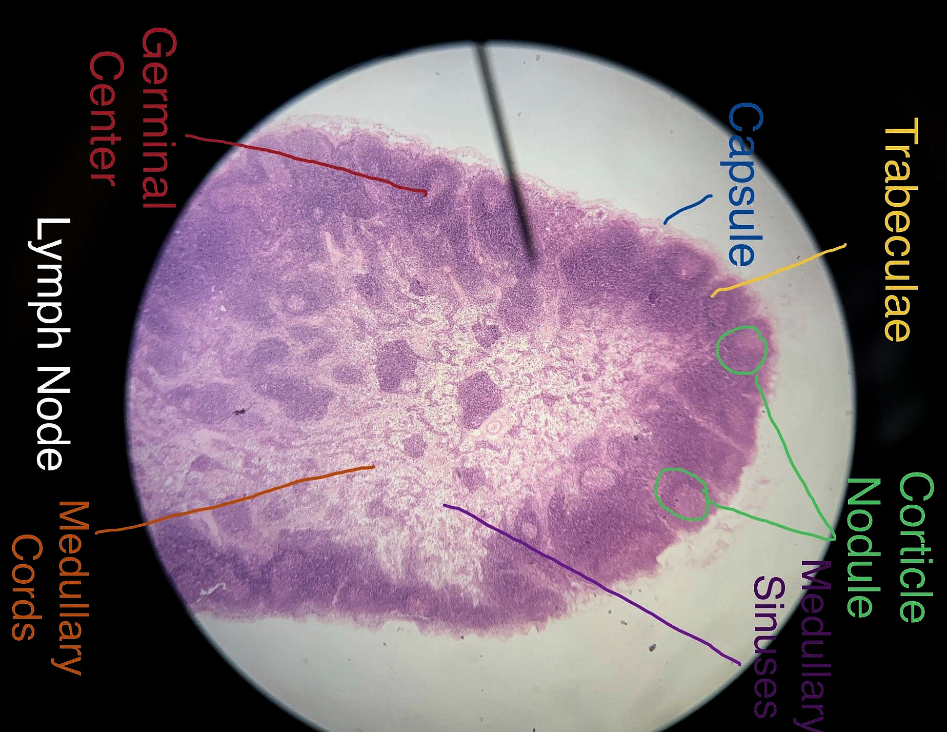 lymph node