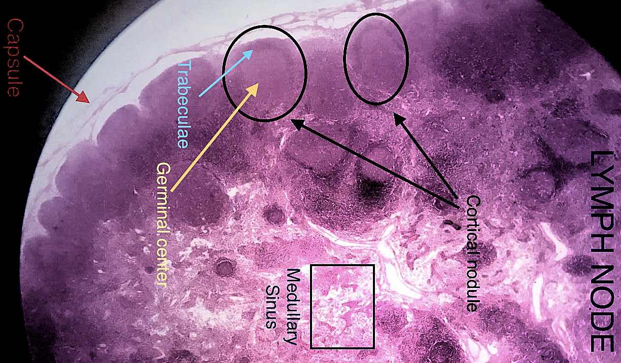 lymph node