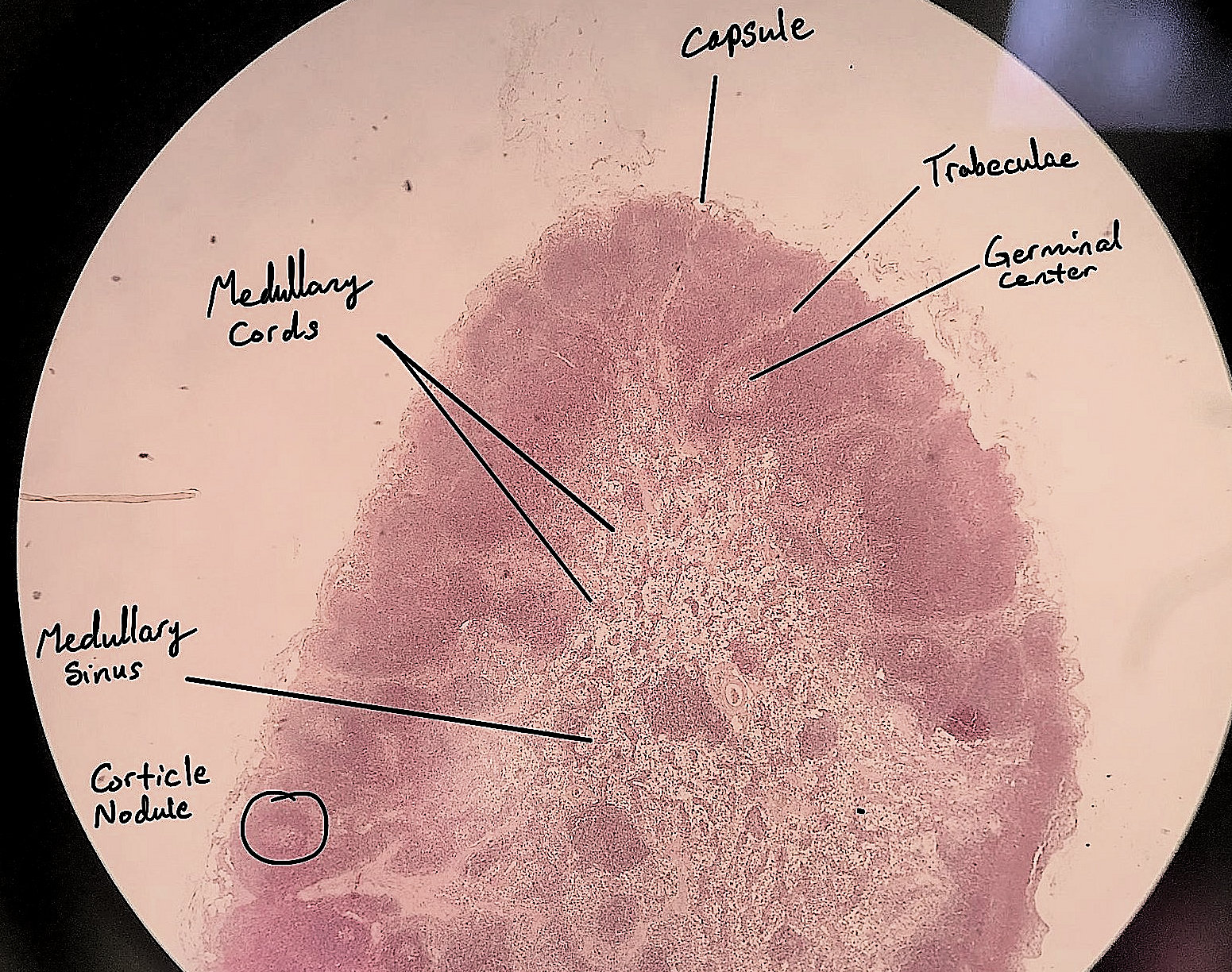 lymph node